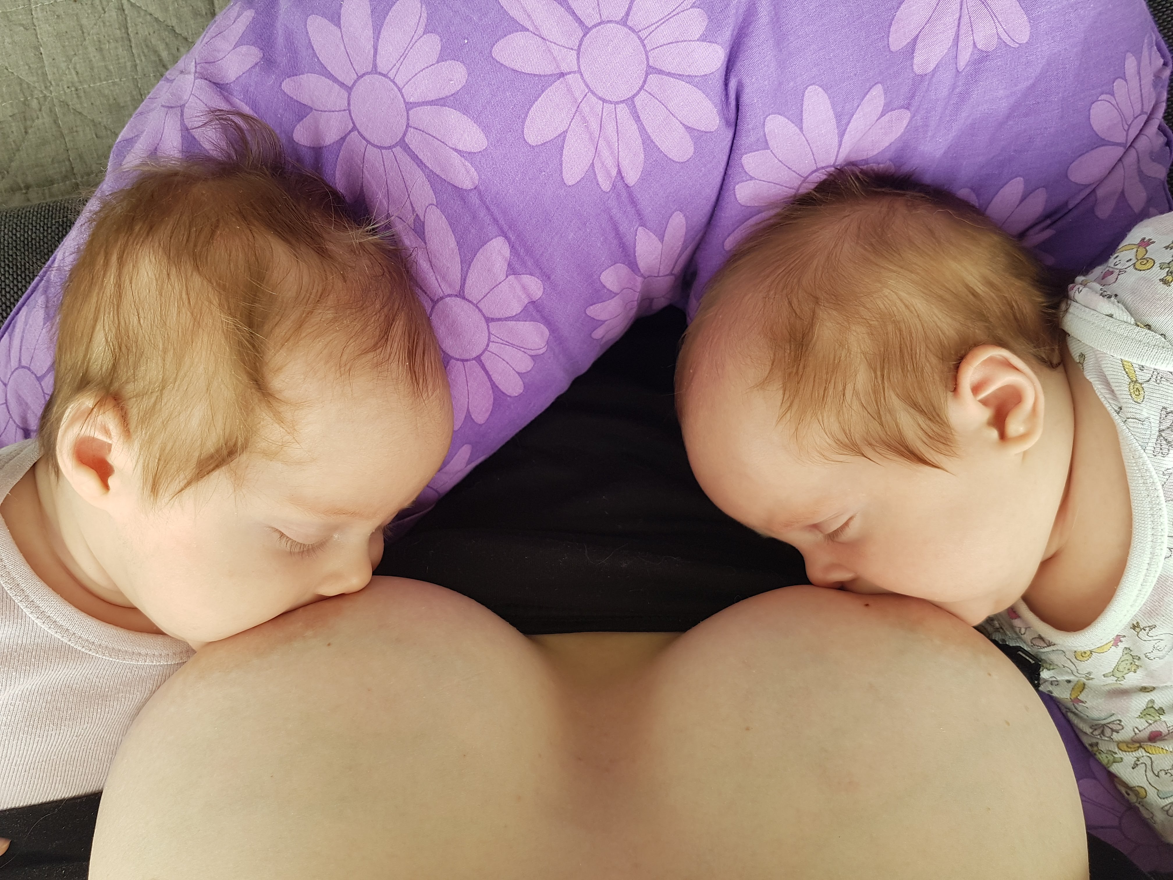 Tvillinger ved brystet
